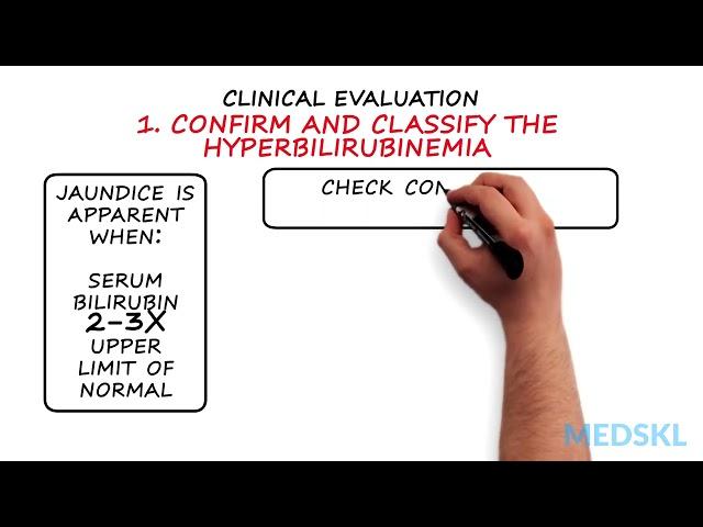 Gastroenterology - Jaundice: By Kelly Burak M.D.