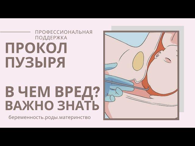 Прокол ПУЗЫРЯ в РОДАХ/АМНИОТОМИЯ/Околоплодный пузырь