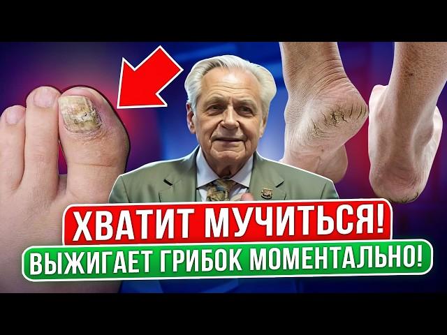Даже многолетний грибок растворился от этого простого рецепта... Грибок ногтей на ногах лечение