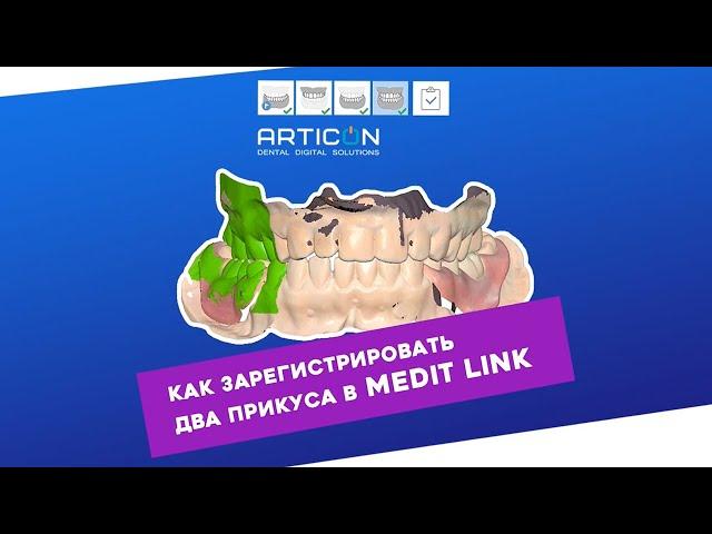 КАК ЗАРЕГИСТРИРОВАТЬ 2 ПРИКУСА В MEDIT LINK | ARTICON