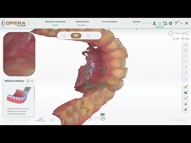 OPERA MACH2 SCANNER INTRAORAL 