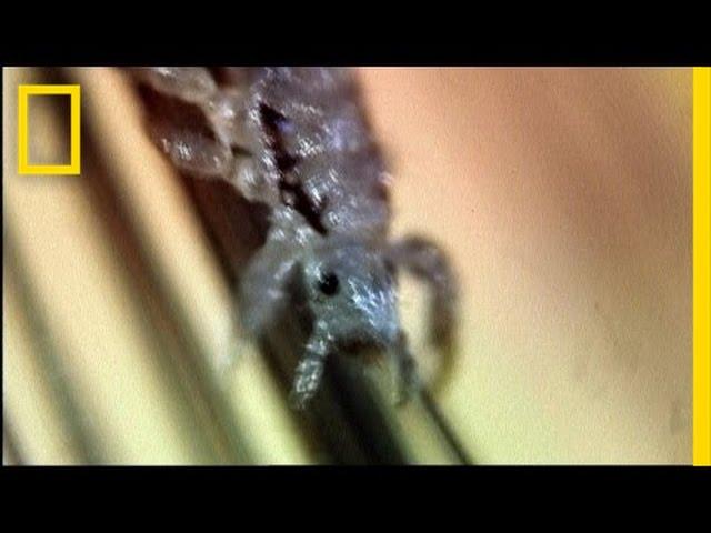 Secret Life of Head Lice | I Didn't Know That