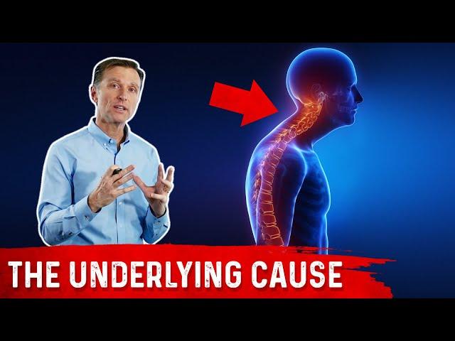 Scoliosis, Kyphosis, Lordosis and Vitamin D Explained by Dr.Berg