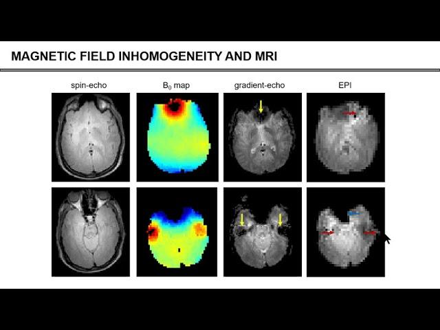 ISMRM MR Academy - Magnetic Field Shimming