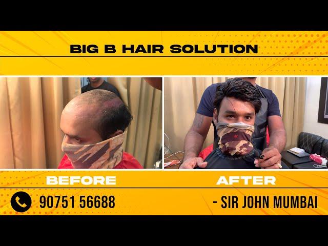 Hair Patch Replacement Service | Sir John | Big B Hair Solution | Mumbai