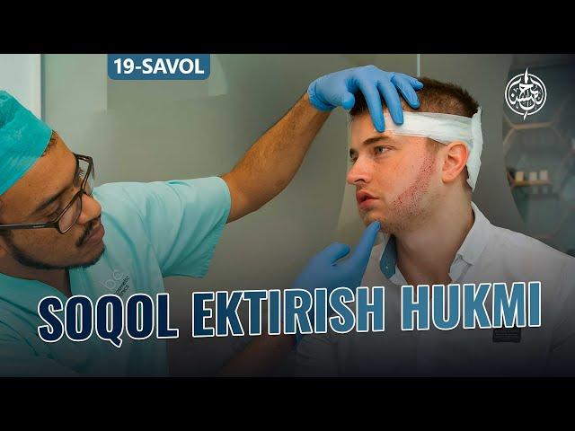 19-savol: Soqol ektirish hukmi.