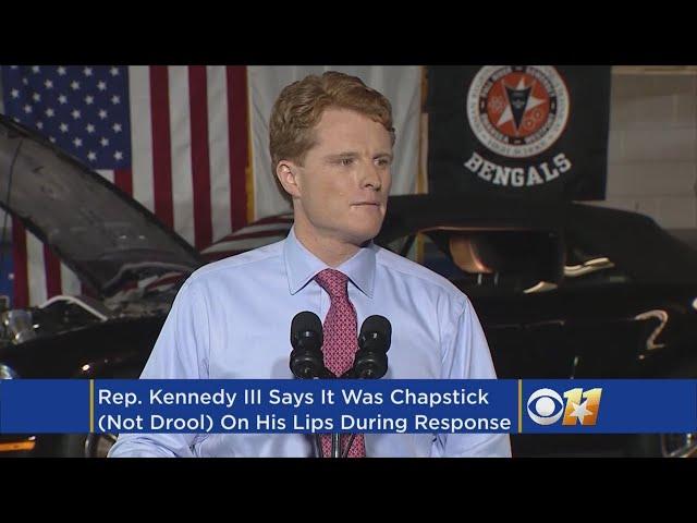 No, That Wasn't Drool On His Lips, Rep. Joe Kennedy Says