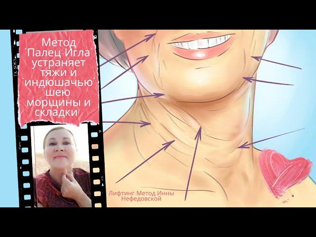 Метод "Палец-Игла" устраняет тяжи и "индюшачью" шею, морщины и складки!