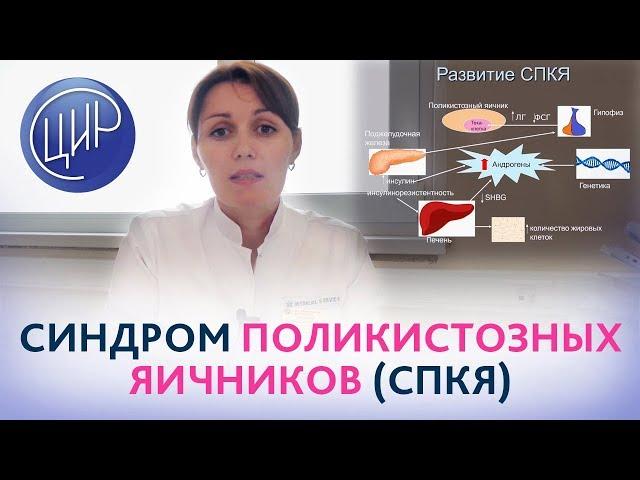 Синдром поликистозных яичников (СПКЯ). Рассказывает врач акушер-гинеколог ЦИР Дюльгер В.П.