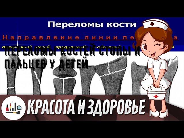 Переломы костей стопы и пальцев у детей