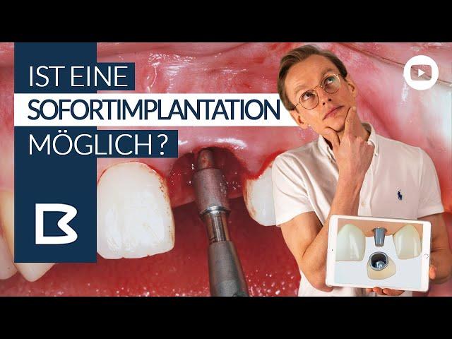 ZahnIMPLANTAT SOFORT? Zahn raus, Implantat rein? Ist das möglich?