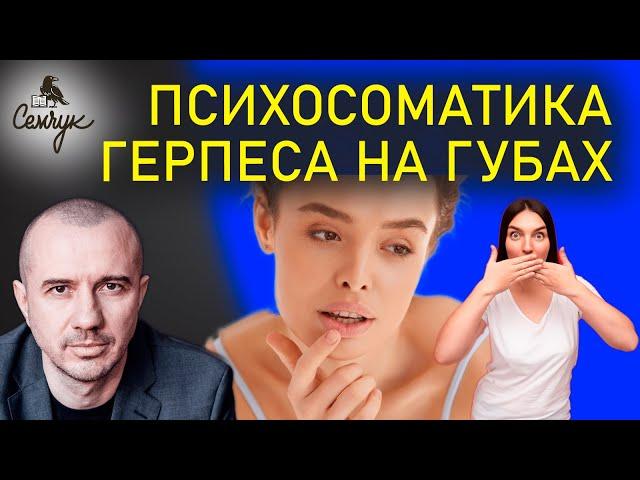 Как убрать герпес раз и навсегда. Вернем красоту своим любимым губам? Феноменальная психосоматика