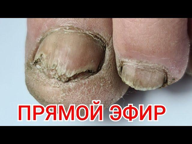 ПЕРЕВОПЛОЩЕНИЕ ПЕДИКЮР ОНЛАЙН  Виктория Авдеева