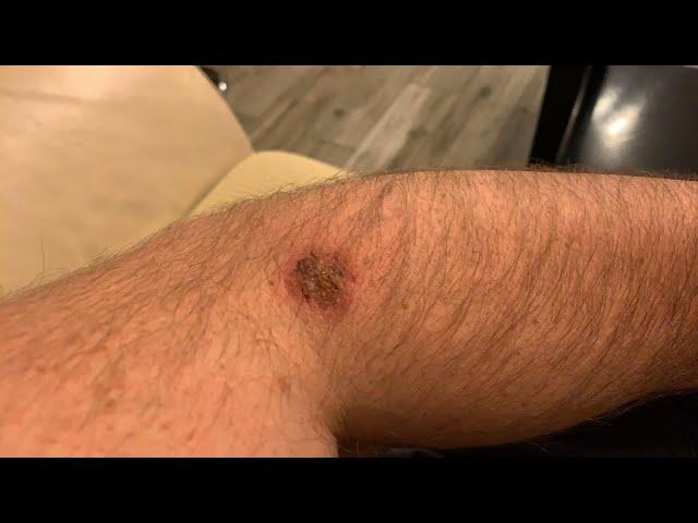 Студия Атлант в Москве. Лечение позвоночника и суставов