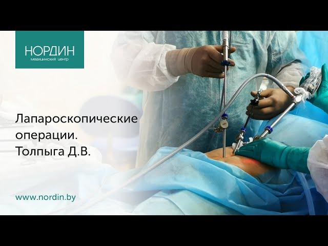 Лапароскопические операции: особенности выполнения, как восстановиться после операции