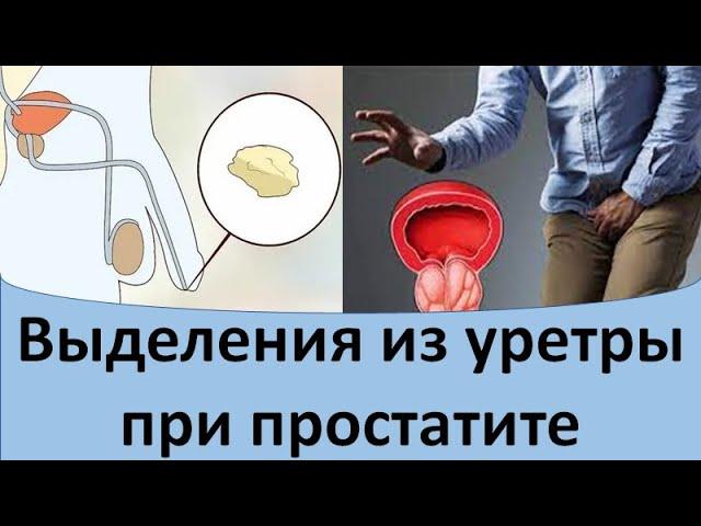 Выделения из уретры при простатите