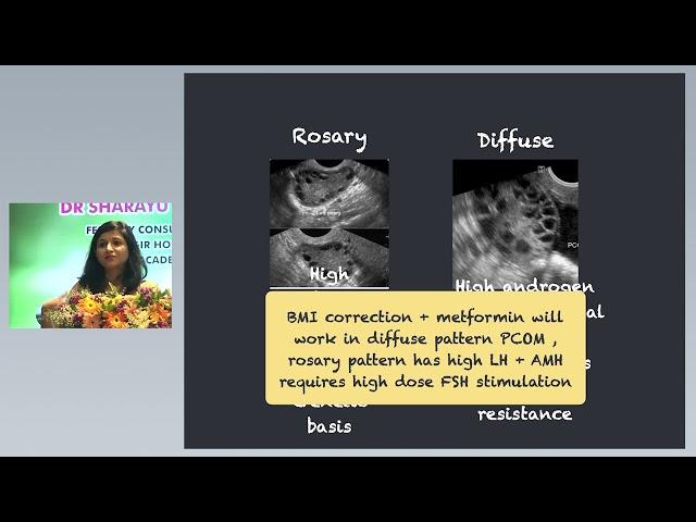 AMH OR AFC FSH INTERPLAY. SIFA Reproductive Physiology Part 1 Workshop.  .....Dr Sharayu Mohite