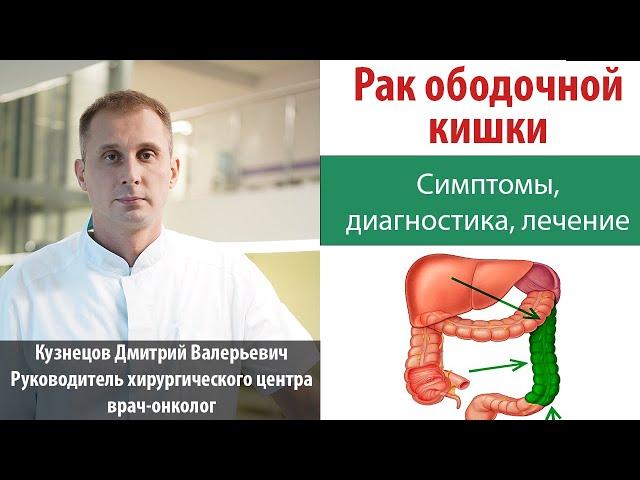 Рак ободочной кишки. Симптомы, диагностика, лечение