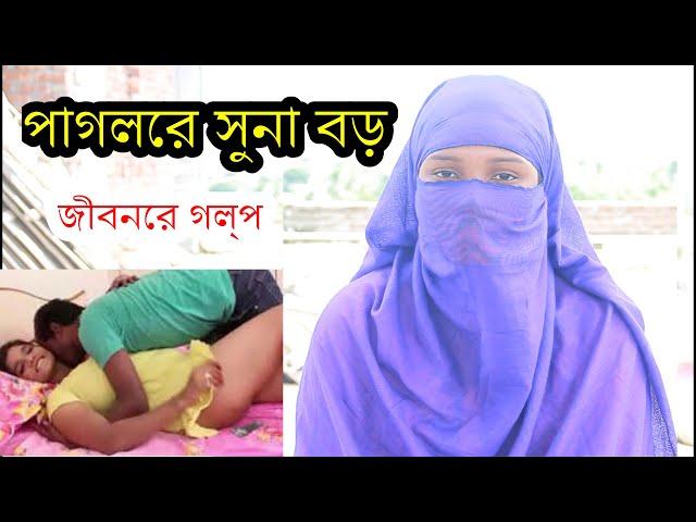 পাগলের যন্ত্র অনেক ভালো লাগে ৷ জীবনের গল্প ৷ Jiboner Golpo  ৷ Rj Glpo