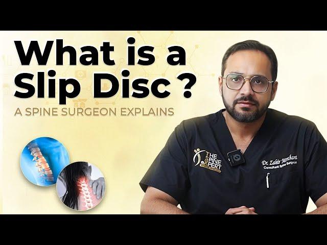 What is a Slip Disc? A Spine Surgeon Explains