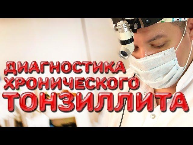 Диагностика хронического тонзиллита | Лечим правильно с Владимиром Зайцевым