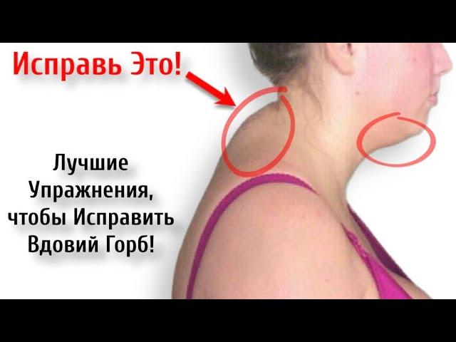 How to eliminate a hump on the neck at home (QUICKLY) | Fix it in 30 days!