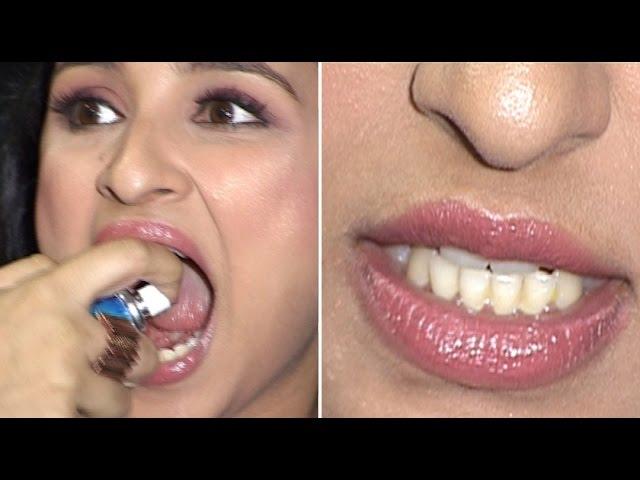 Parineeti Chopra Shows Off Her Dirty Yellow Teeth! OOPS SHE DID IT AGAIN…