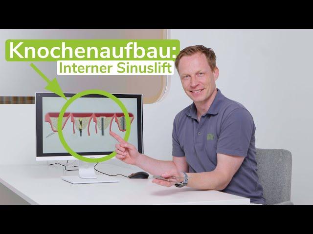 Knochenaufbau: Interner Sinuslift - Was ist das? | Dr. Frank-Ch. Langer - m71 Sankt Augustin