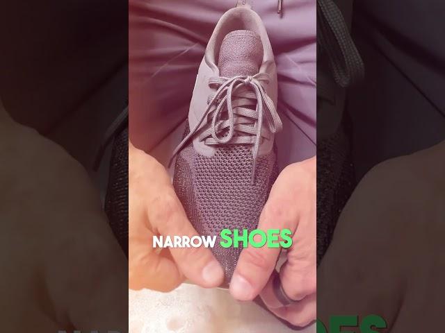 Say Goodbye to Ingrown Toenails for Good! #feet