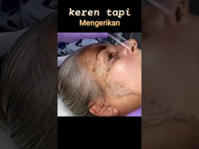 Ngeri perawatan wajah pengangkatan sel kulit mati #shorts #skincare #perawatanwajah #wajahawetmuda