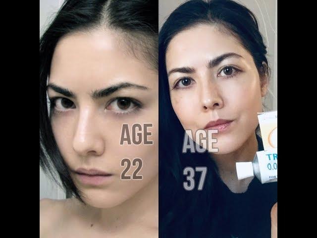 Does Retin-A (Tretinoin) Delay Skin Aging? 15 Year Review | Beginners Guide | Neck & Chest Update