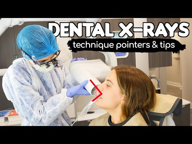 How To Take PERFECT Dental X-rays | Tips & Tricks From A Dental Hygienist