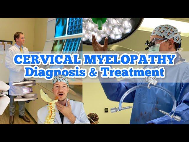 What is Cervical Myelopathy, how to test for it, and how to treat it