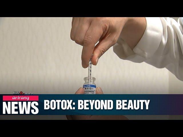 Botox becoming increasingly known for medical benefits