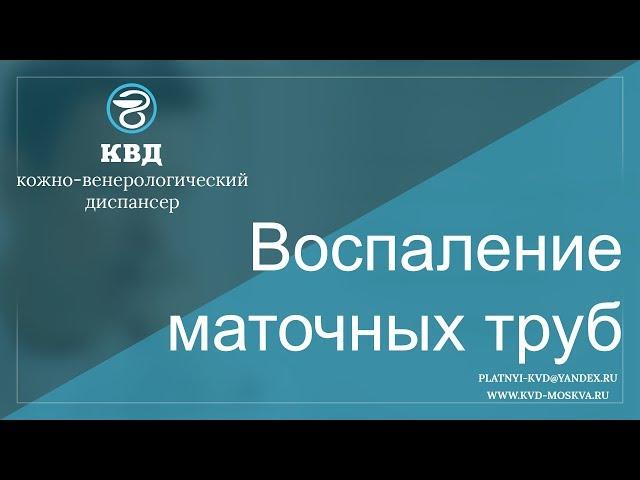 464  Воспаление маточных труб