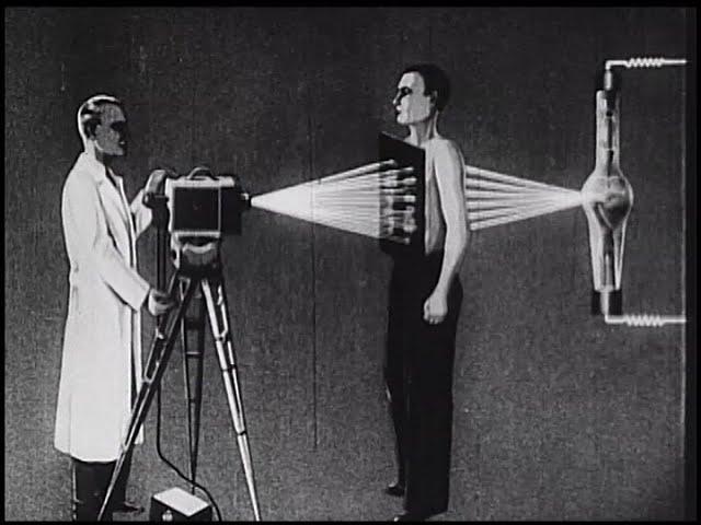 Moving X-Rays (UFA Films, Inc., 1938)