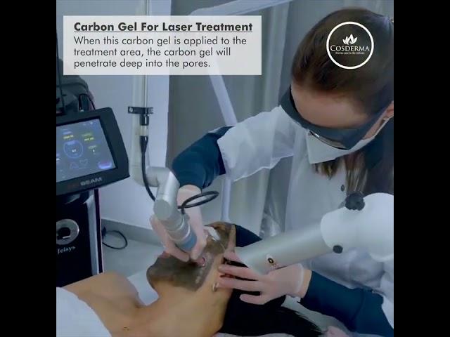 carbon laser facial Mira road Newderma aesthetic clinic