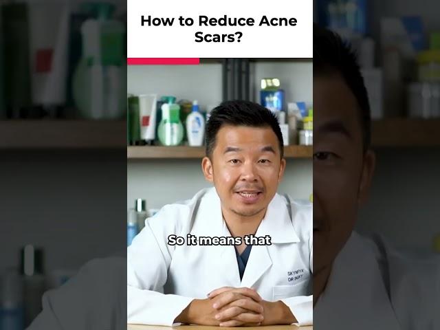 5 Ways To Reduce Acne Scars