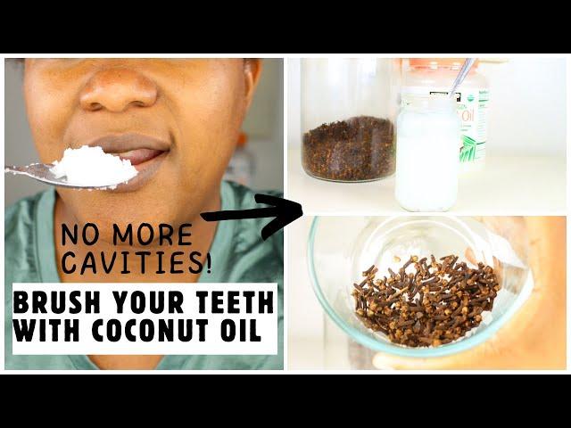 NO MORE CAVITIES IF YOU USE THIS! | OIL PULLING USING COCONUT OIL & CLOVES! NATURAL TOOTHPASTE