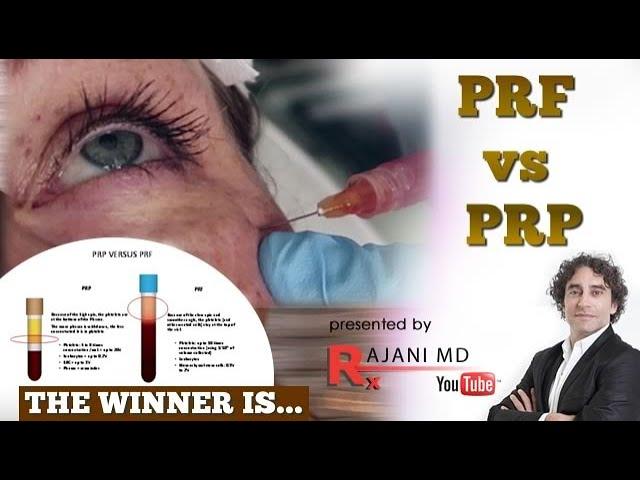 PRF vs PRP  Head to Head Comparison -The First Study