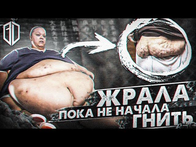 Живот ВЕСОМ 300 КГ! Что С НЕЙ СТАЛО???