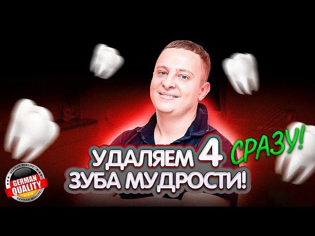 Удаление 4 зуба мудрости одновременно