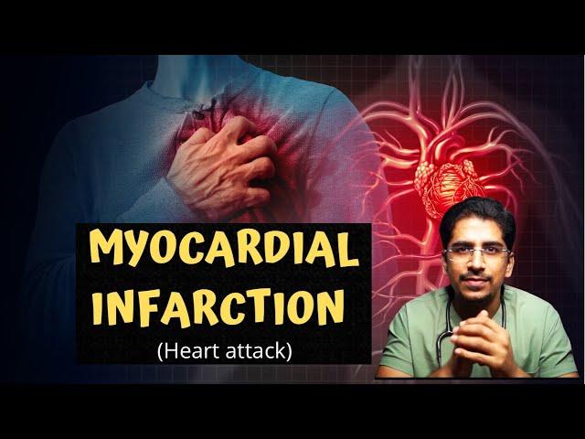 MYOCARDIAL INFARCTION (MI) | Heart attack -in 20mins!