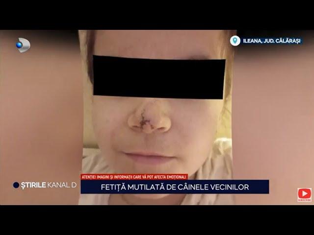 Stirile Kanal D - Fetita mutilata de cainele vecinilor | Editie de seara