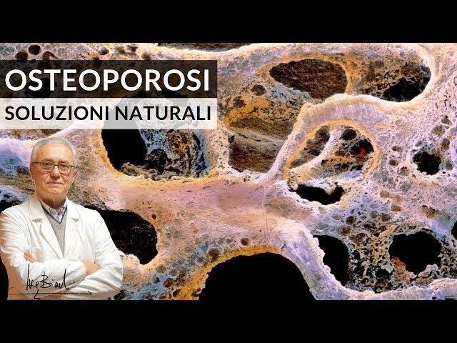 Osteoporosi, Prevenzione e Soluzioni Naturali