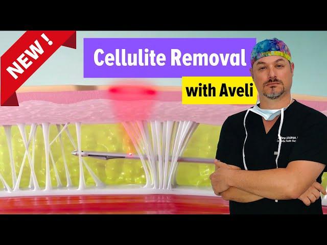 Aveli Cellulite Reduction