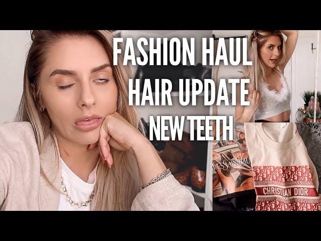 VLOG - New Teeth, Fashion / Beauty Haul & A Hair Update | Fashion Influx