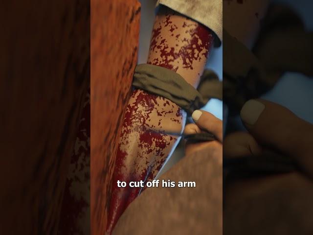 The Man Who Cut Off His Own Arm 