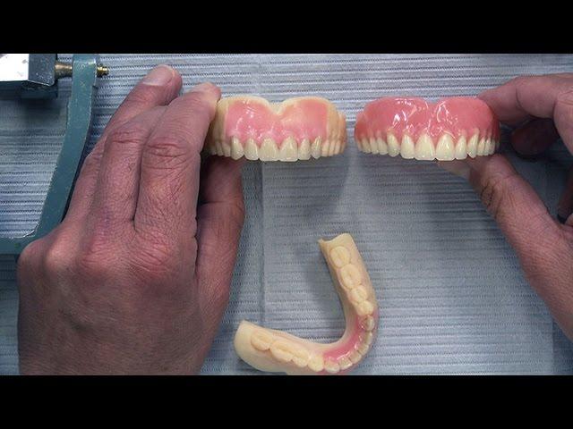 Case of the week: Highlighting the CAD/CAM Denture Process