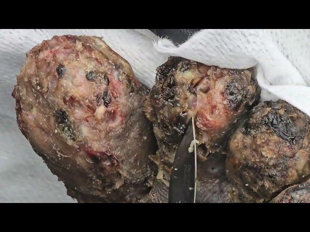 Philip Butabila -  jiggers, dead skin #2 ---long videos @riseupsociety.net & @ruskenya.org